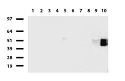 FCGR1A Mouse anti-Human, Clone: UMAB74, liquid, UltraMAB 30 &mu;L; Unconjugated:Antibodies,