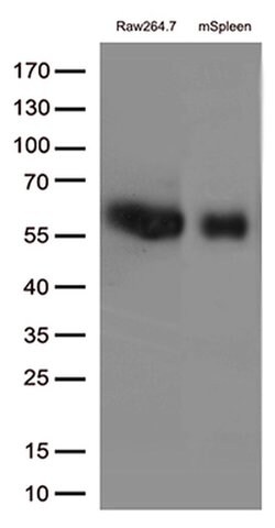 FCGR1A Mouse anti-Human, Clone: UMAB74, liquid, UltraMAB 30 &mu;L; Unconjugated:Antibodies,