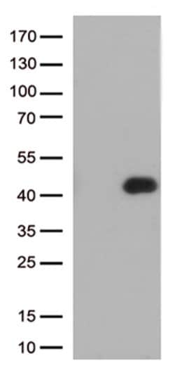 FCGR2A Mouse anti-Human, Clone: OTI13G9, lyophilized, TrueMAB 100 &mu;g;