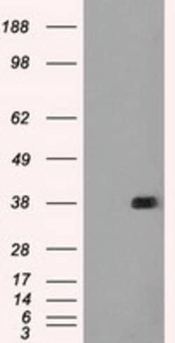 FCGR2A Mouse anti-Human, Clone: OTI6D11, lyophilized, TrueMAB 100 &mu;g;