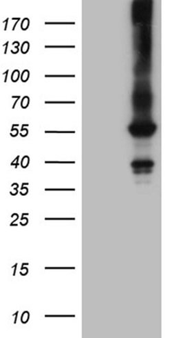 FCRLB Monoclonal Antibody (OTI5H5), TrueMAB , OriGene:Antibodies:Primary