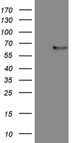 FCRLB Monoclonal Antibody (OTI1D7), TrueMAB , OriGene:Antibodies:Primary