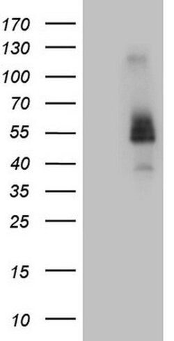 FCRLB Monoclonal Antibody (OTI5H6), TrueMAB , OriGene:Antibodies:Primary