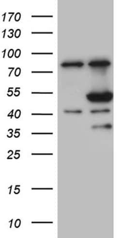 FCRLB Monoclonal Antibody (OTI6H8), TrueMAB , OriGene 100 &mu;L; Unconjugated:Antibodies,