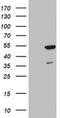 FEN1 Monoclonal Antibody (OTI1E1), TrueMAB , OriGene 100 &mu;L; Unconjugated:Antibodies,