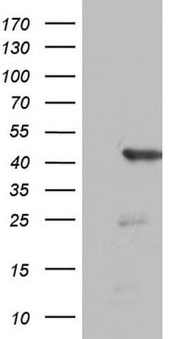 FEN1 Monoclonal Antibody (OTI2B2), TrueMAB , OriGene:Antibodies:Primary
