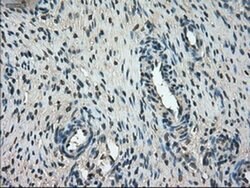 FERMT2 Mouse anti-Human, Clone: OTI25A4, liquid, TrueMAB 30 &mu;L; Unconjugated:Antibodies,