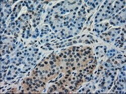 FERMT2 Mouse anti-Human, Clone: OTI25A4, lyophilized, TrueMAB 100 &mu;g;