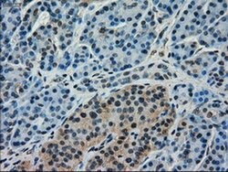 FERMT2 Mouse anti-Human, Clone: OTI25A4, liquid, TrueMAB 30 &mu;L; Unconjugated:Antibodies,