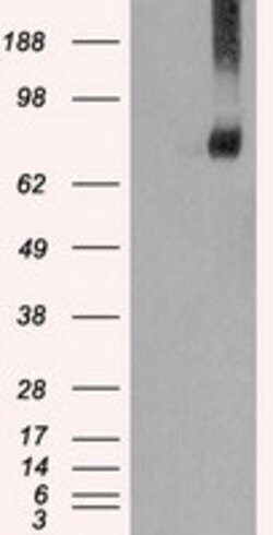 FERMT2 Mouse anti-Human, Clone: OTI25A4, lyophilized, TrueMAB 100 &mu;g;
