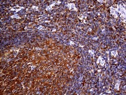 FERMT3 Monoclonal Antibody (OTI2H10), TrueMAB , OriGene:Antibodies:Primary