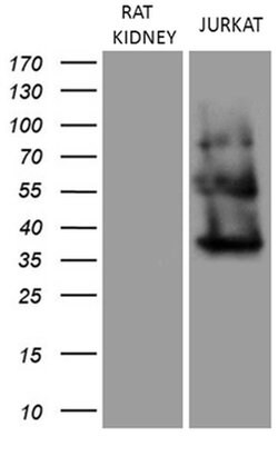 FERMT3 Monoclonal Antibody (OTI2H10), TrueMAB , OriGene:Antibodies:Primary