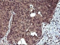 FGF21 Monoclonal Antibody (OTI2F10), TrueMAB , OriGene:Antibodies:Primary
