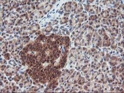 FGF21 Monoclonal Antibody (OTI2F10), TrueMAB , OriGene 30 &mu;L; Unconjugated:Antibodies,