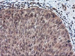FGF21 Monoclonal Antibody (OTI2F10), TrueMAB , OriGene 30 &mu;L; Unconjugated:Antibodies,