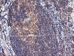 FGF21 Monoclonal Antibody (OTI2F10), TrueMAB , OriGene:Antibodies:Primary
