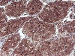 FGF21 Monoclonal Antibody (OTI2F10), TrueMAB , OriGene 30 &mu;L; Unconjugated:Antibodies,