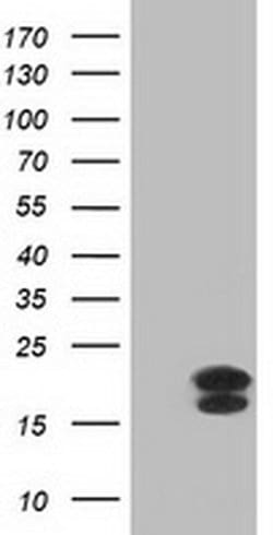 FGF21 Monoclonal Antibody (OTI4B2), TrueMAB , OriGene 100 &mu;L; Unconjugated:Antibodies,