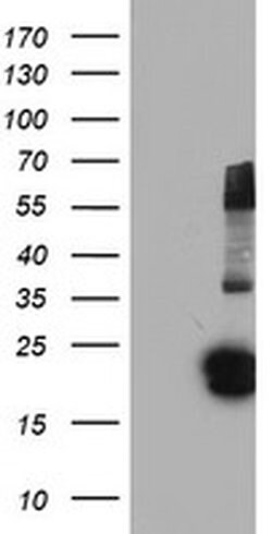 FGF21 Monoclonal Antibody (OTI2F10), TrueMAB , OriGene 30 &mu;L; Unconjugated:Antibodies,