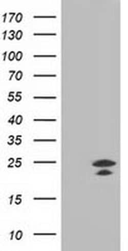 FGF21 Monoclonal Antibody (OTI1H5), TrueMAB , OriGene 100 &mu;L; Unconjugated:Antibodies,