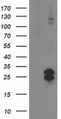 FGF21 Monoclonal Antibody (OTI2F8), TrueMAB , OriGene 100 &mu;L; Unconjugated:Antibodies,