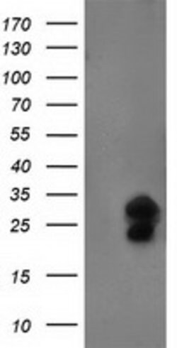 FGF21 Mouse anti-Human, Clone: OTI2B9, lyophilized, TrueMAB 100 &mu;g;