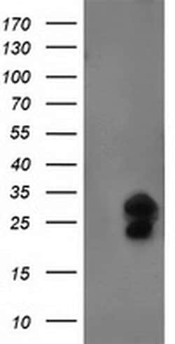 FGF21 Monoclonal Antibody (OTI2B9), TrueMAB , OriGene:Antibodies:Primary
