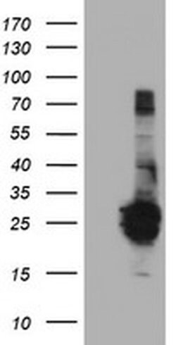 FGF21 Monoclonal Antibody (OTI2E2), TrueMAB , OriGene 100 &mu;L; Unconjugated:Antibodies,