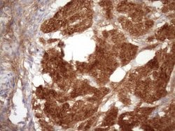 FGFBP1 Mouse anti-Human, Clone: OTI2B6, lyophilized, TrueMAB 100 &mu;g;