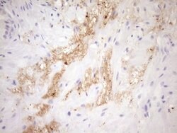 FGFBP1 Monoclonal Antibody (OTI2B6), TrueMAB , OriGene:Antibodies:Primary