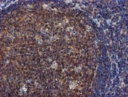 FGFR2 Mouse anti-Human, Clone: OTI3F8, lyophilized, TrueMAB 100 &mu;g;