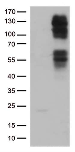 FGFR2 Monoclonal Antibody (OTI1D3), TrueMAB , OriGene 100 &mu;L; Unconjugated:Antibodies,