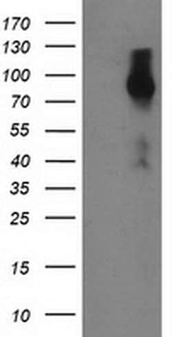 FGFR2 Monoclonal Antibody (OTI1A11), TrueMAB , OriGene:Antibodies:Primary