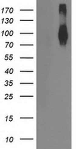 FGFR2 Monoclonal Antibody (OTI2D1), TrueMAB , OriGene 100 &mu;L; Unconjugated:Antibodies,