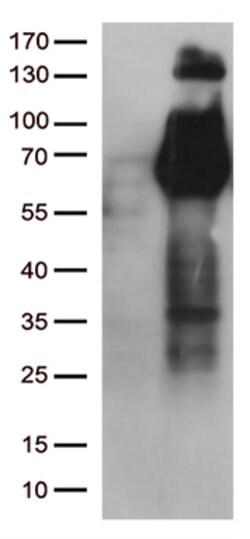 FGFR2 Mouse anti-Human, Clone: OTI4D6, lyophilized, TrueMAB 100 &mu;g;