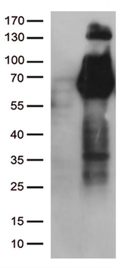 FGFR2 Monoclonal Antibody (OTI4D6), TrueMAB , OriGene 100 &mu;L; Unconjugated:Antibodies,