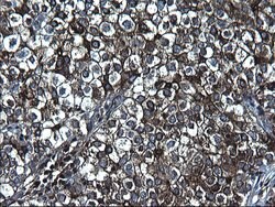 FGG Monoclonal Antibody (OTI1D11), TrueMAB , OriGene 100 &mu;L; Unconjugated:Antibodies,