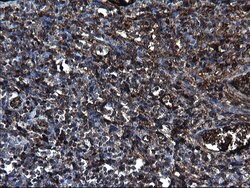 FGG Mouse anti-Human, Clone: OTI5D7, lyophilized, TrueMAB 100 &mu;g; Unconjugated:Antibodies,