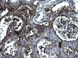 FGG Mouse anti-Human, Clone: OTI5D7, lyophilized, TrueMAB 100 &mu;g; Unconjugated:Antibodies,