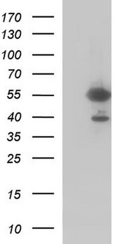 FGG Monoclonal Antibody (OTI1D11), TrueMAB , OriGene 100 &mu;L; Unconjugated:Antibodies,