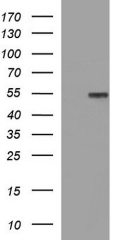 FGG Mouse anti-Human, Clone: OTI2B6, lyophilized, TrueMAB 100 &mu;g; Unconjugated:Antibodies,