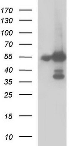 FGG Monoclonal Antibody (OTI2D2), TrueMAB , OriGene 100 &mu;L; Unconjugated:Antibodies,