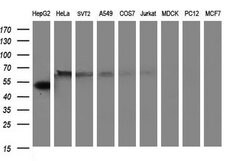 FGG Monoclonal Antibody (OTI2D2), TrueMAB , OriGene 100 &mu;L; Unconjugated:Antibodies,