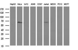 FGG Mouse anti-Human, Clone: OTI5D7, lyophilized, TrueMAB 100 &mu;g; Unconjugated:Antibodies,