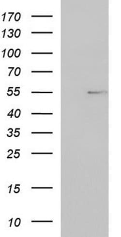 FGG Mouse anti-Human, Clone: OTI4G2, lyophilized, TrueMAB 100 &mu;g; Unconjugated:Antibodies,