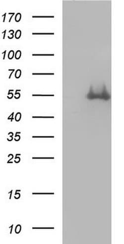 FGG Monoclonal Antibody (OTI5C9), TrueMAB , OriGene 30 &mu;L | Buy Online | Origene Technologies | Fisher Scientific