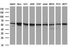 FGG Monoclonal Antibody (OTI5C9), TrueMAB , OriGene 30 &mu;L | Buy Online | Origene Technologies | Fisher Scientific