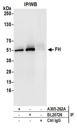 FH/Fumarate Hydratase Rabbit anti-Human, Mouse, Polyclonal, Bethyl Laboratories