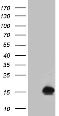 FHIT Monoclonal Antibody (OTI2C2), TrueMAB , OriGene 100 &mu;L | Buy Online | Origene Technologies | Fisher Scientific