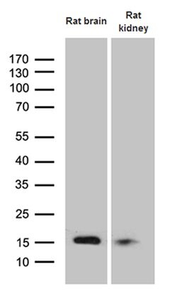 FHIT Monoclonal Antibody (OTI2C2), TrueMAB , OriGene 100 &mu;L | Buy Online | Origene Technologies | Fisher Scientific